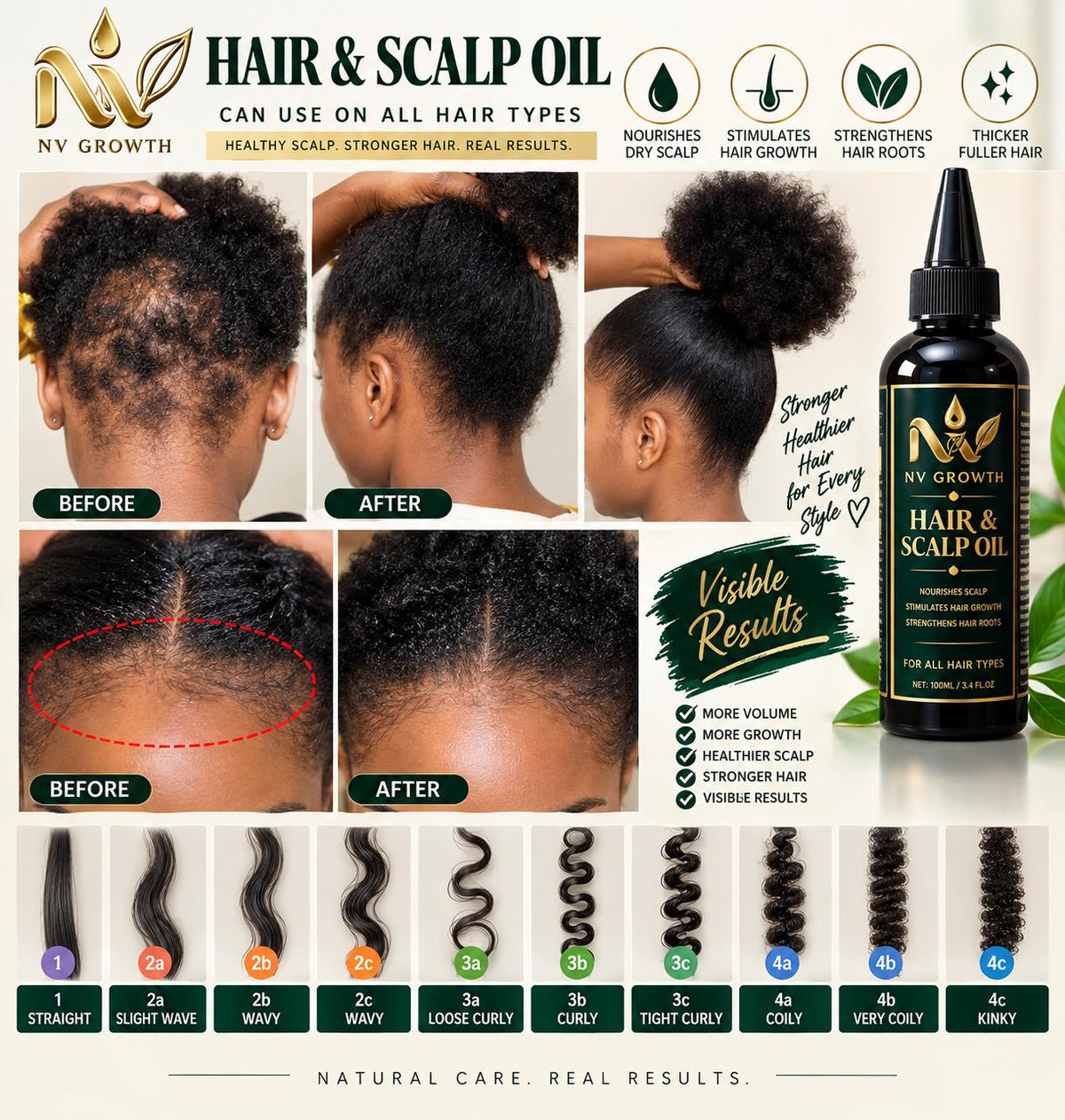 NV Growth Hair & Scalp Oil – 100ml